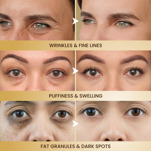 Eye Revive Cream