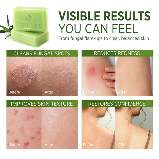 Tea Tree Oil Soap