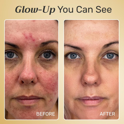 NuroDerma™