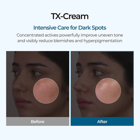 TX Cream