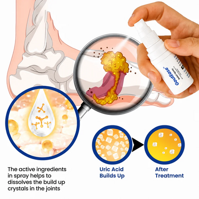 GoutEase™ Gout Relief Spray