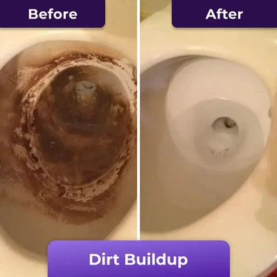BowlBlast™ - Toilet Cleaning Foam