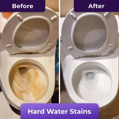 BowlBlast™ - Toilet Cleaning Foam