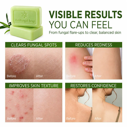 Tea Tree Oil Soap