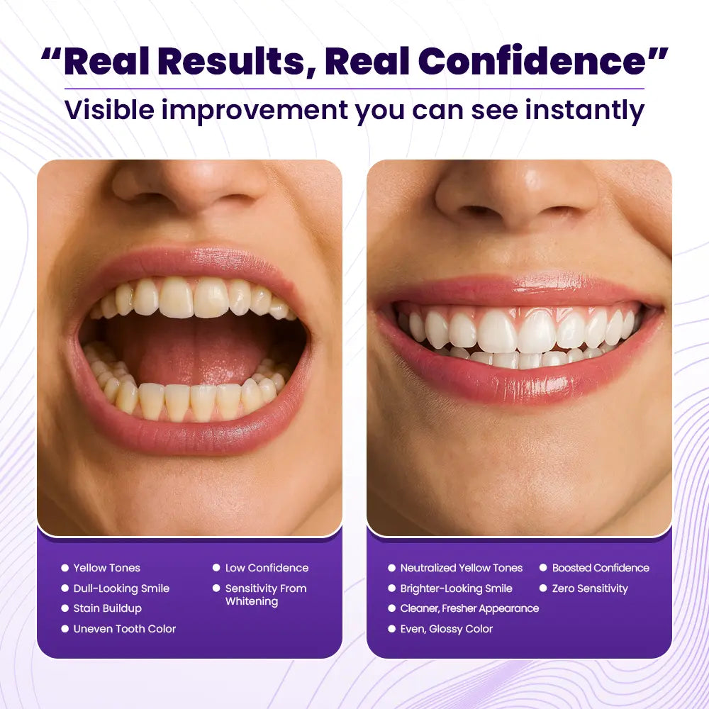 V36 Teeth Color Corrector